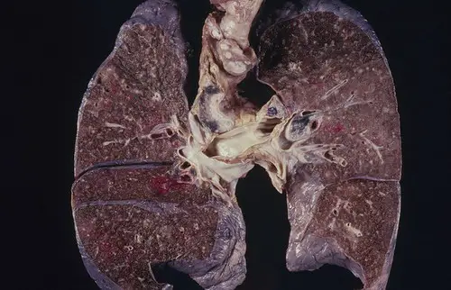 human lungs